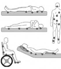 ulceras por presión