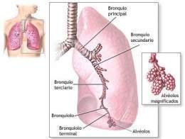 neumon&iacute;a por aspiraci&oacute;n - &iquest;Sabes qu&eacute; puede causar una neumon&iacute;a en ancianos? y consejos para evitarla